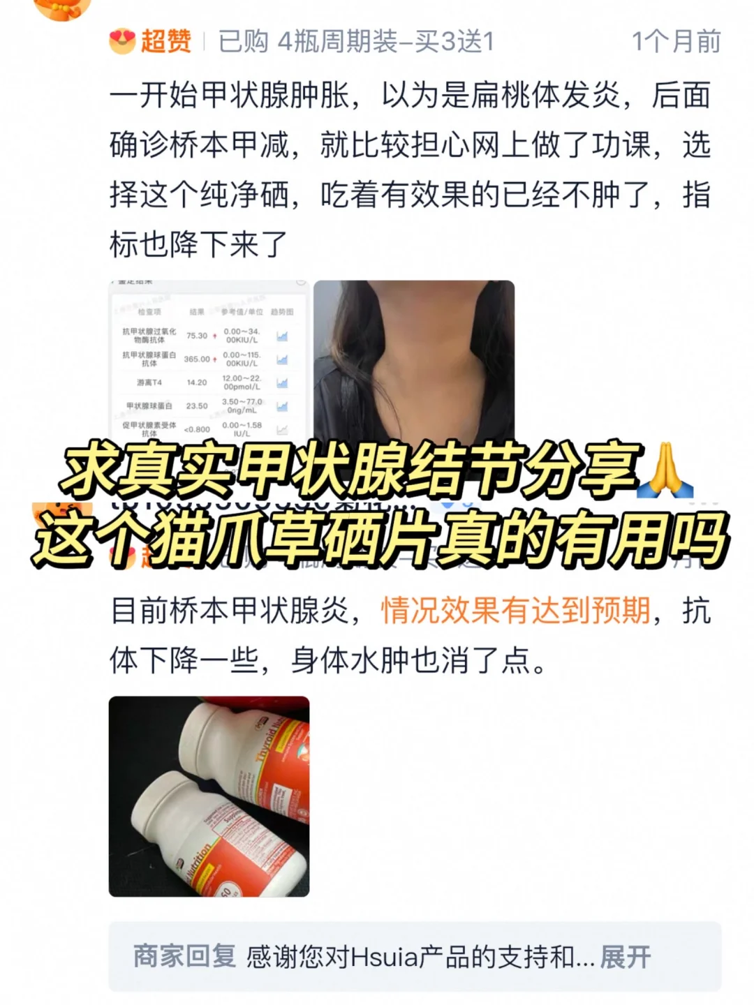 结节4a，补猫爪草到想哭，有没有懂的姐妹..