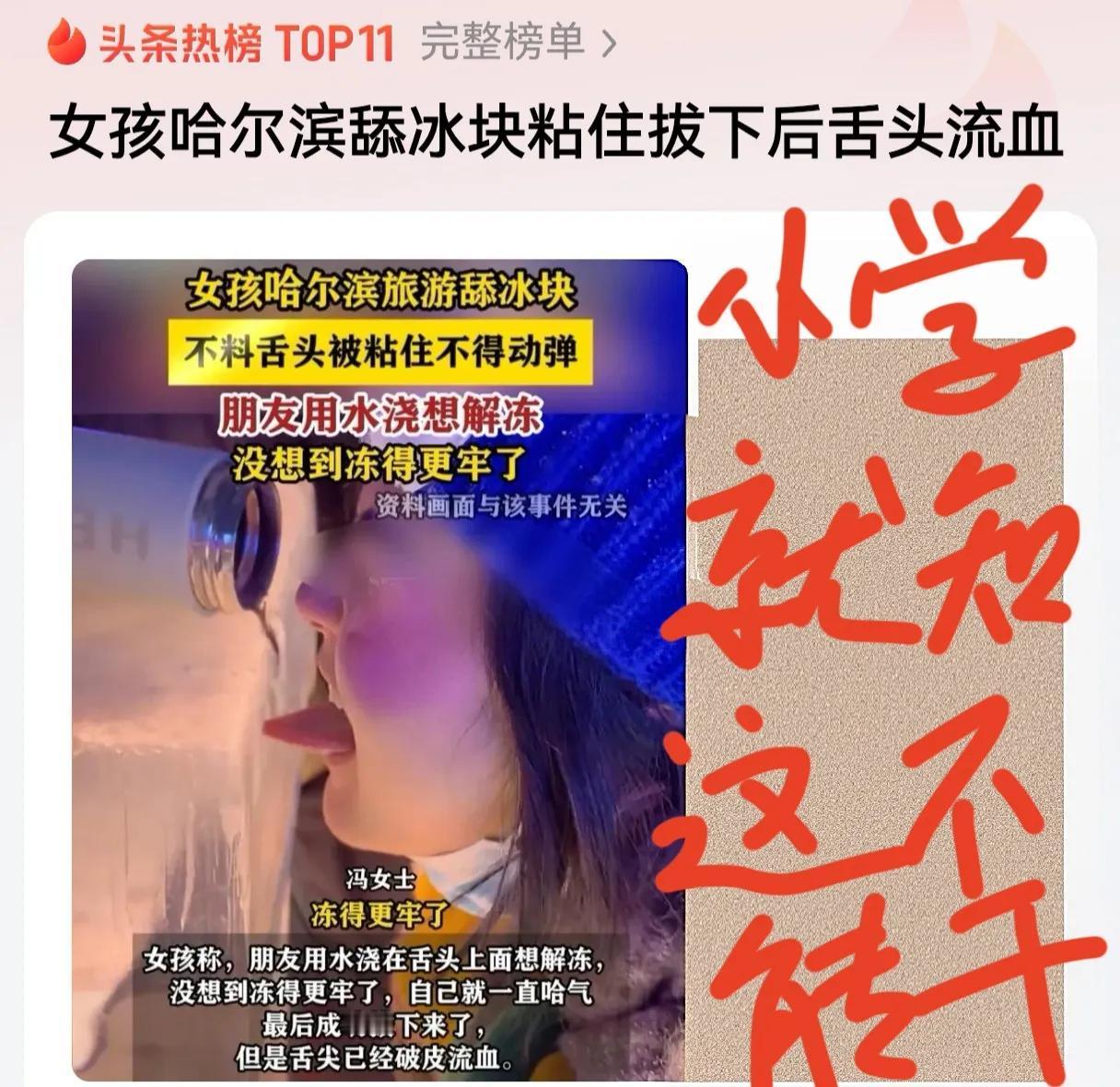 女孩在哈尔滨伸舌头乱舔，结果舌头流血了！

小学就知道冬天舌头别乱舔，最典型的是