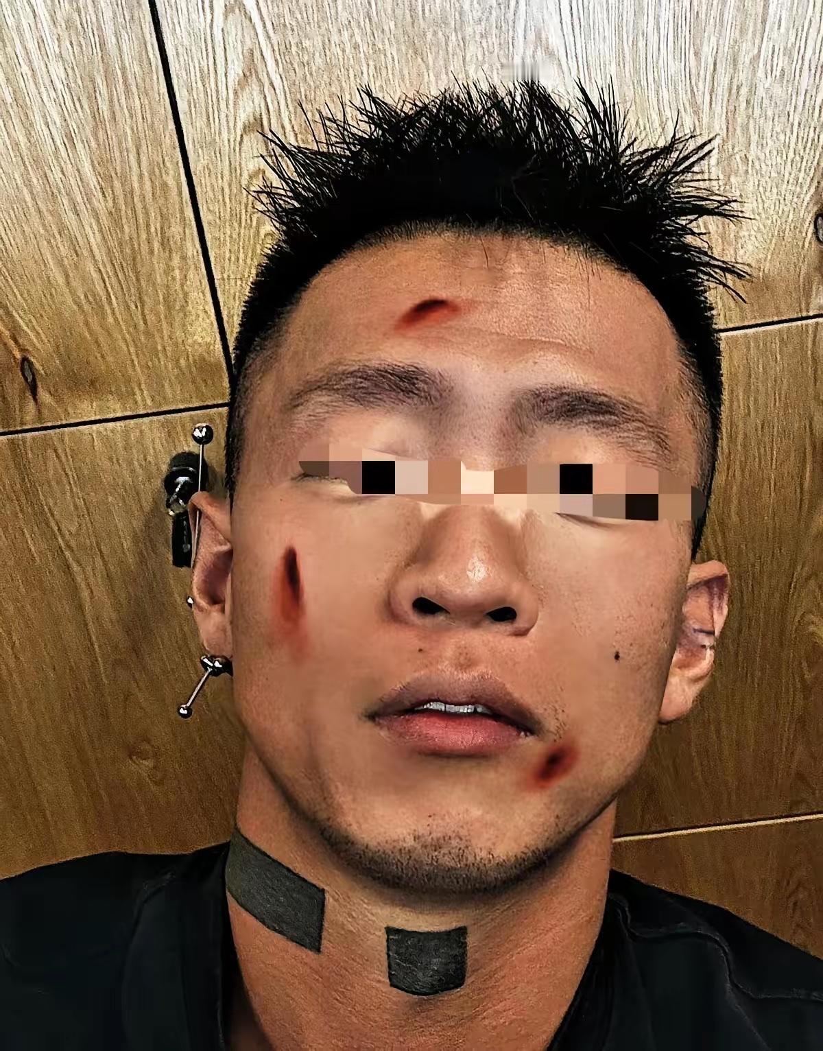 刚攥着大学录取通知书的那天，亲爸抄起修车铁管把我三根肋骨打断，就为了护着后妈带来