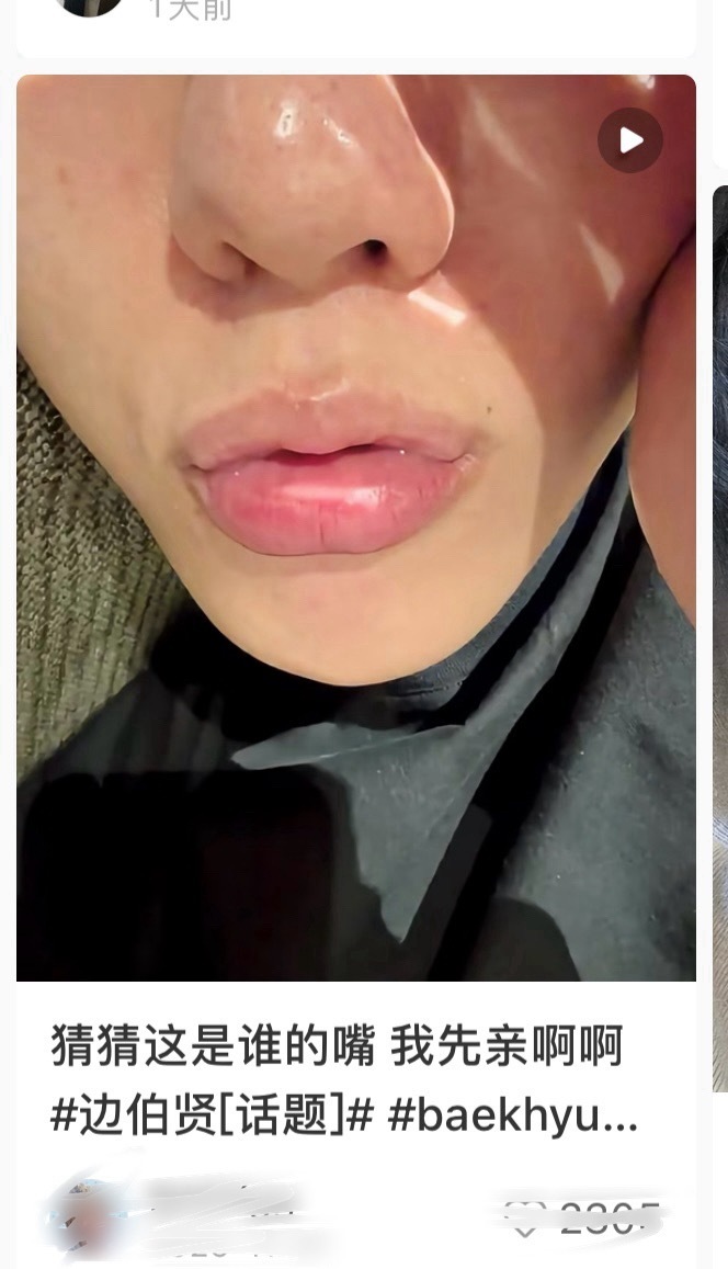 边伯贤嘴巴怎么凑凑的吴世勋 净化一下 ​​​