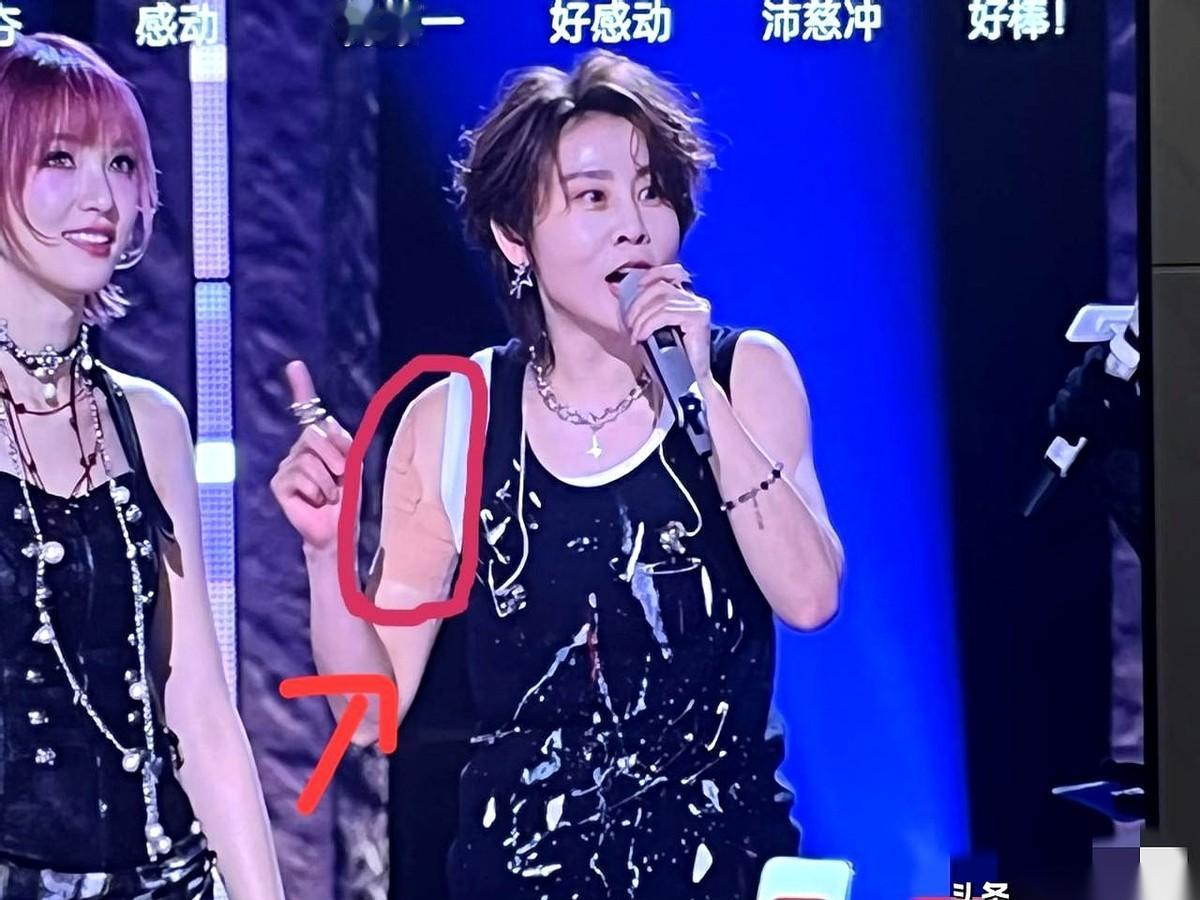 王濛上《浪姐》，胳膊上那块大膏药，让不少人心疼坏了。
都以为是老伤复发，是训练太