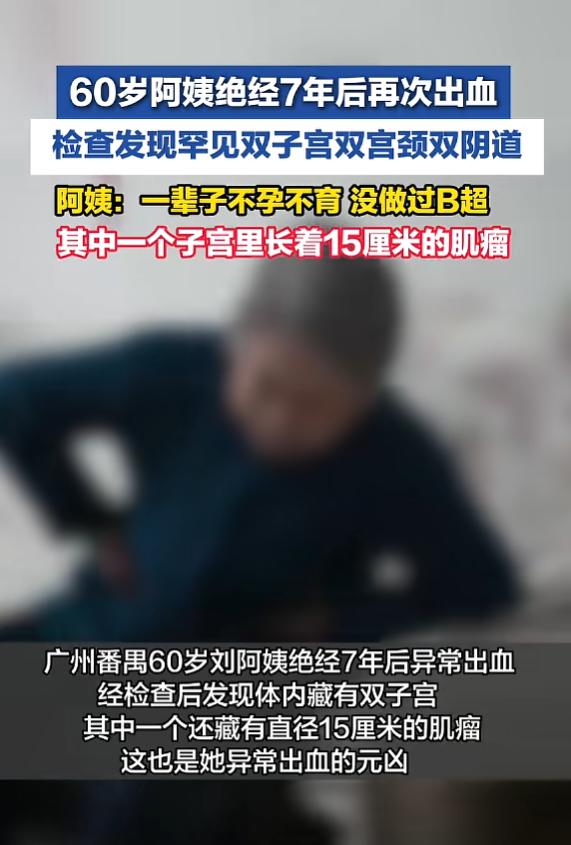 “开眼了！”7月12日报道，广东广州，一60岁阿姨绝经7年后，下体出现不规则出血