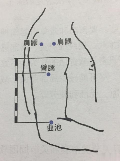 #秋冬到“肩膀疼”# 一般肩周问题的形成有内、外两个因素。内因是年老体弱，肝肾不