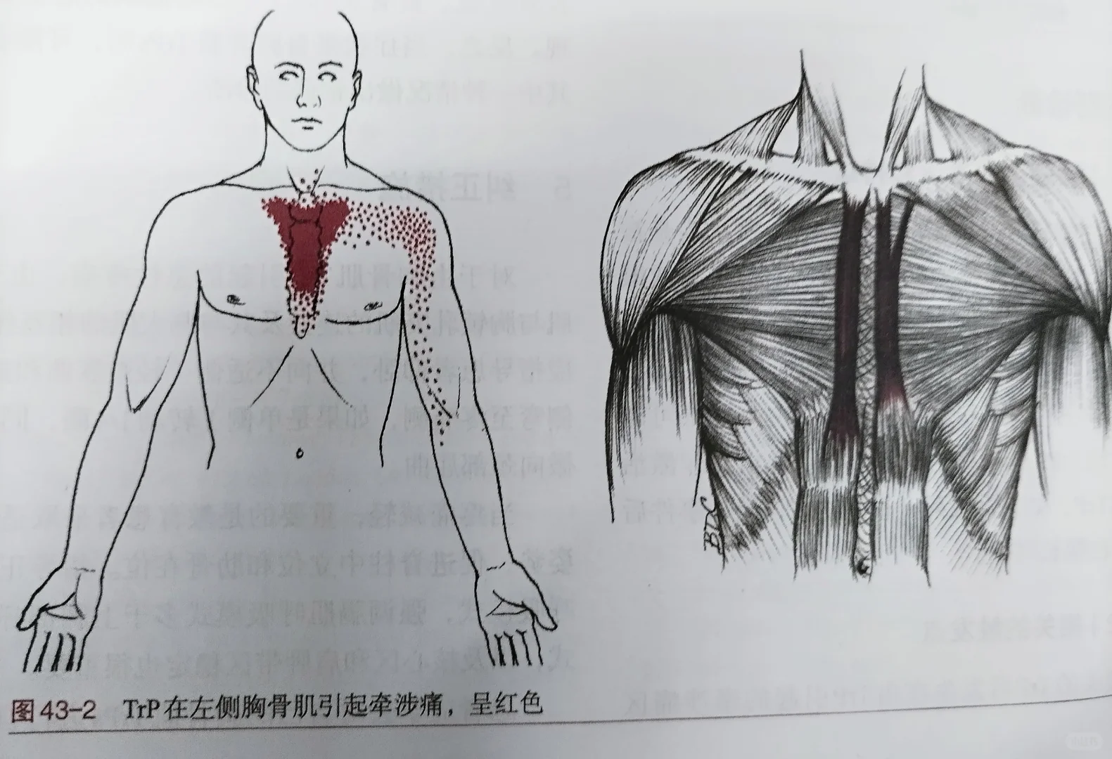 胸骨肌表现