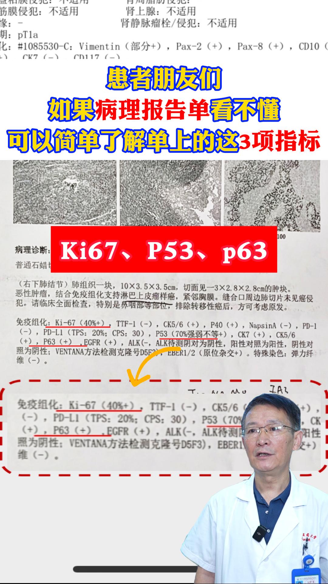 年前体检复查，这两天检查结果应该都出来了，我知道很多人拿到厚厚一沓病理报告单时，