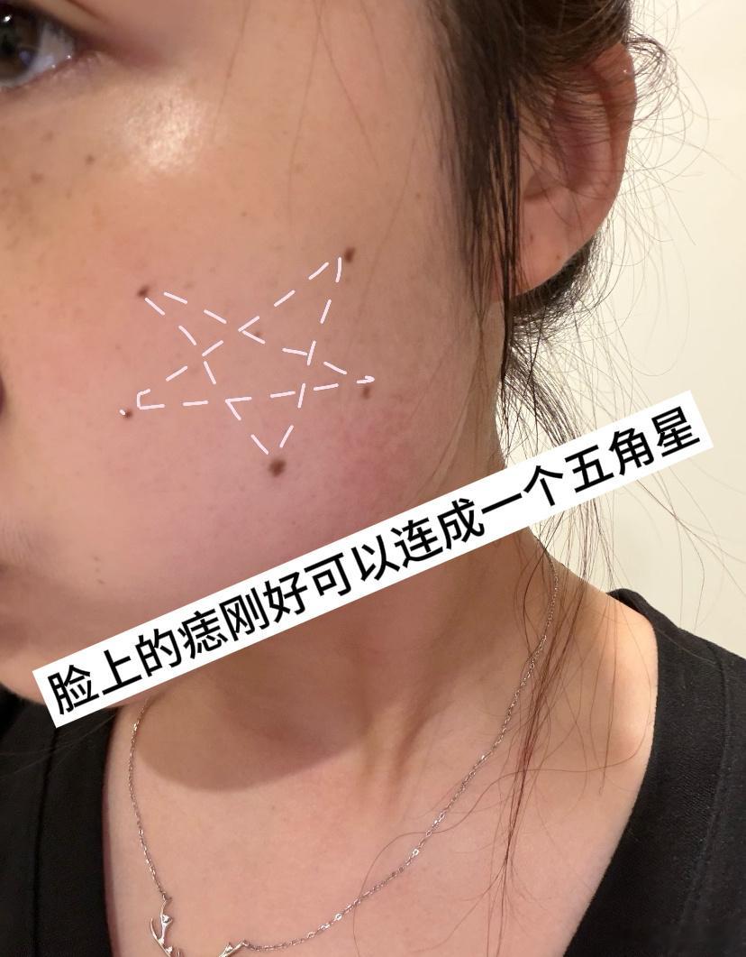 每颗痣都长得刚刚好