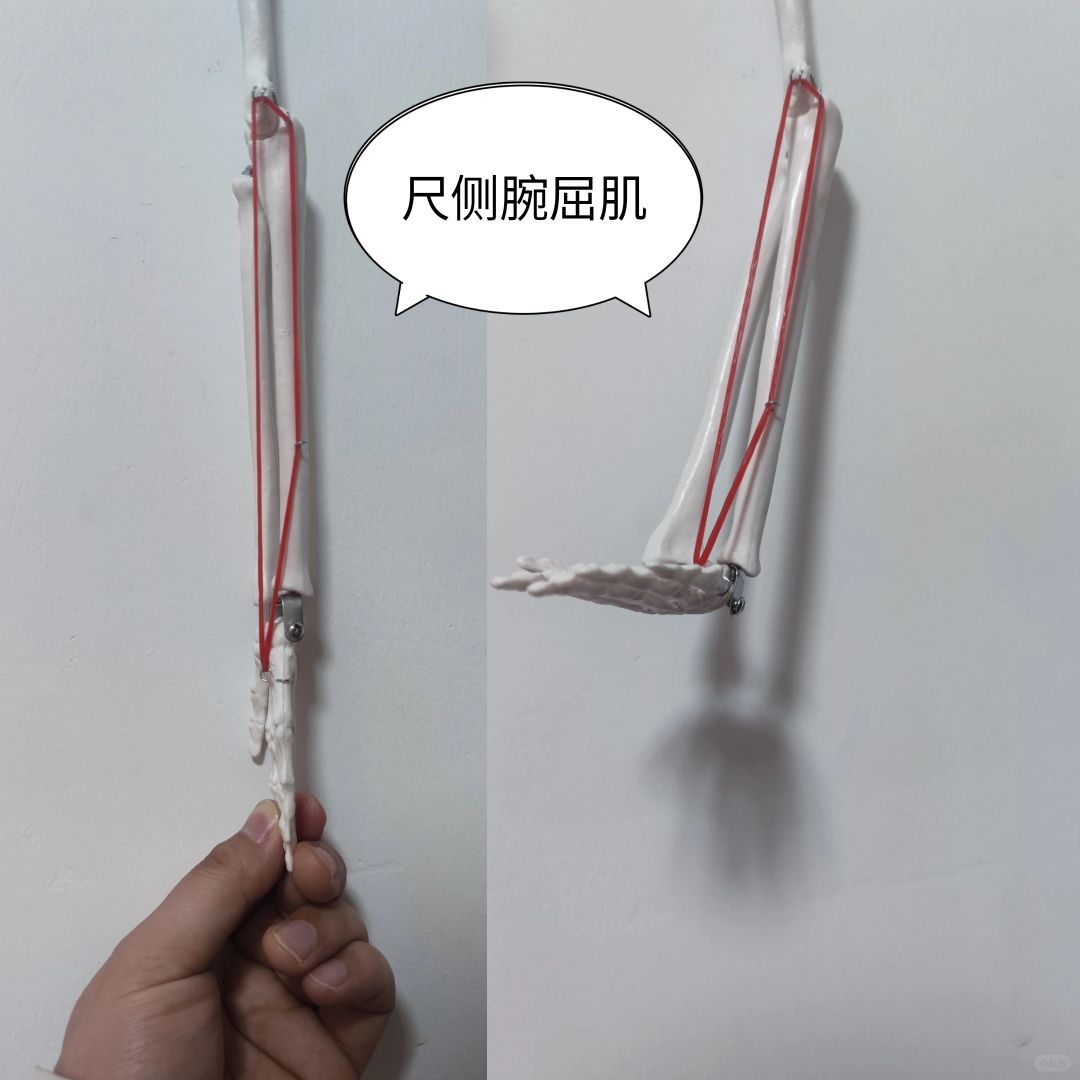 尺侧腕屈肌