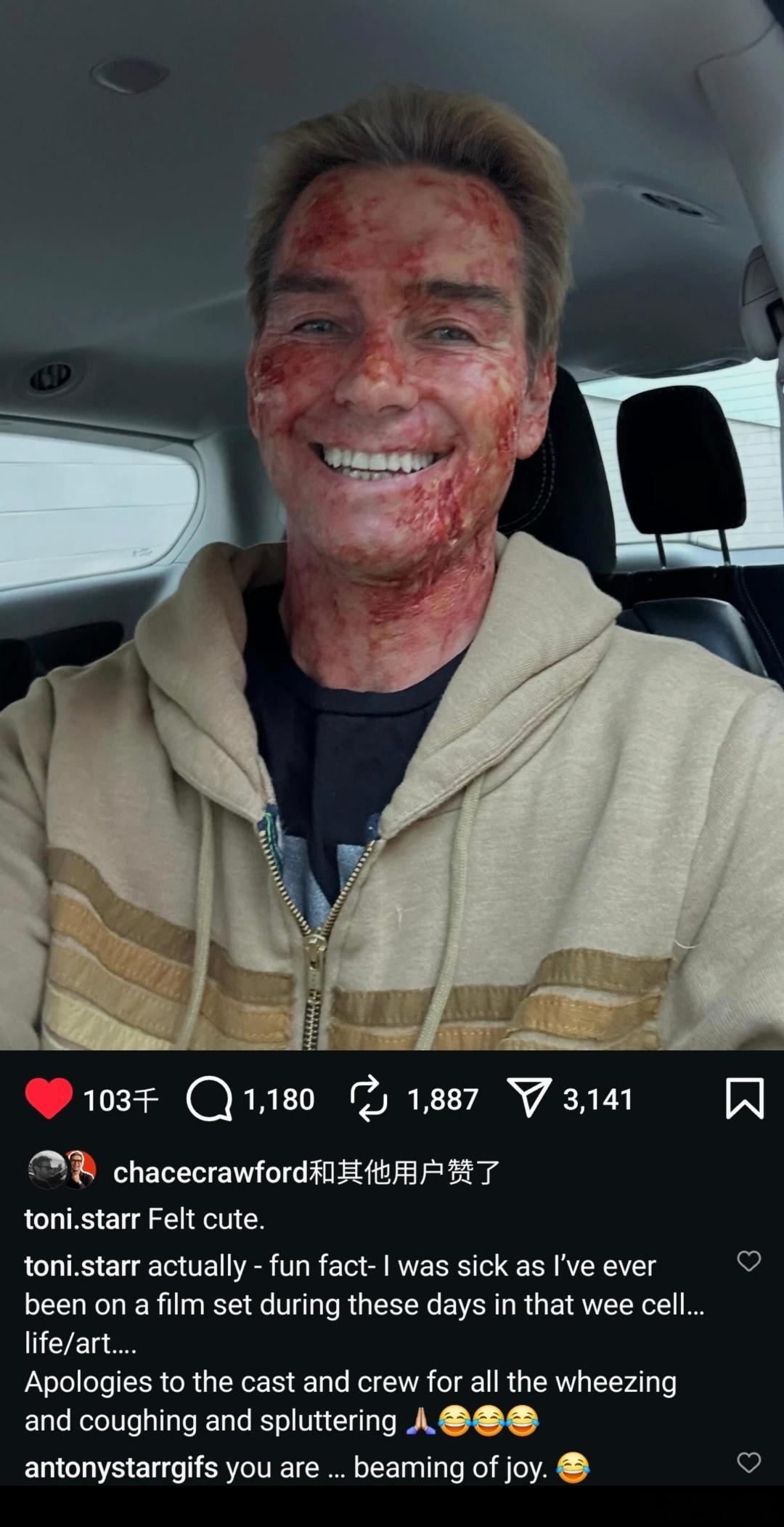 原来，阿祖被关在铀辐射隔离舱，本人安东尼也本来生病了。有趣的是，深海点赞了这条动