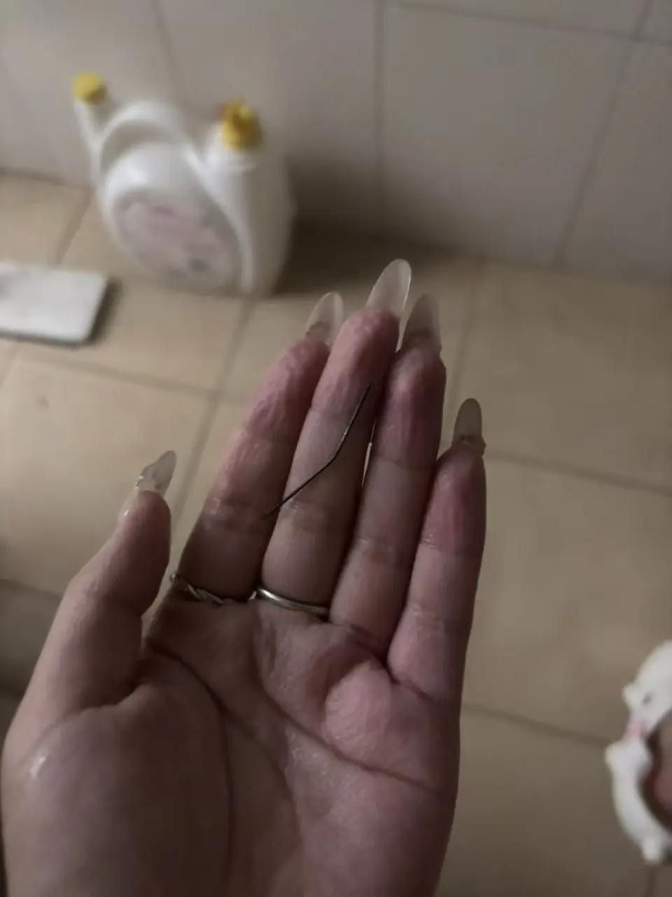 说实话，看到这则新闻的时候，我后背都麻了一下。

浙江一位女士，左臀疼了整整一个