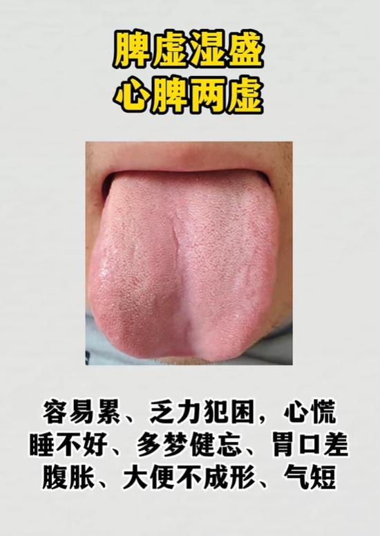 看舌辨虚实，心脾、脾肾、肝火痰湿区分