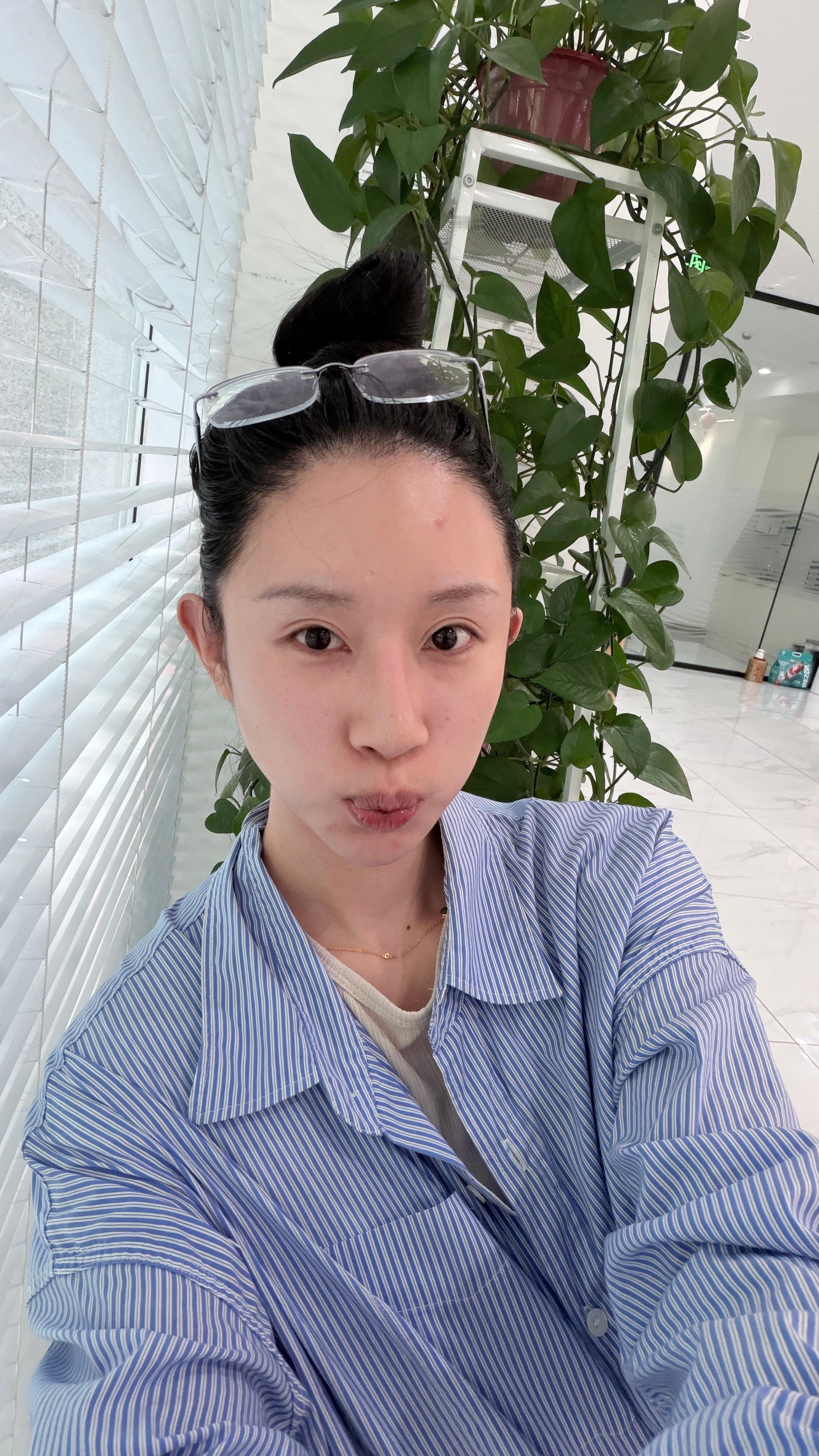 偶真的是很干很干的皮 平时的油润都是涂出来的。 现在洗完脸只喷了点水，感觉要裂开
