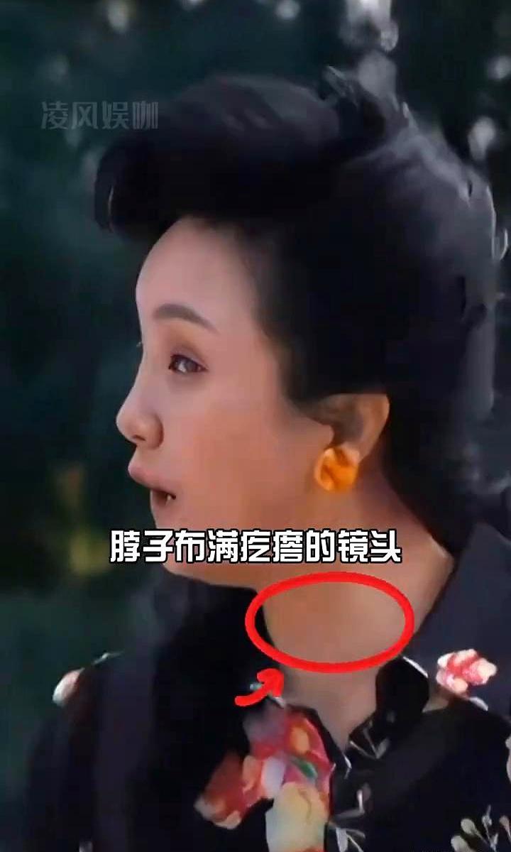 监视器后面。
辛柏青第一次情绪崩溃。
因为朱媛媛脖子上那个东西，根本不该出现在一