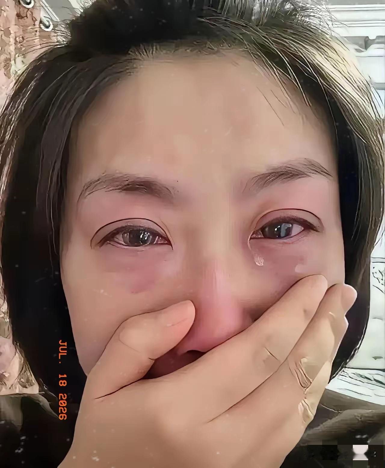 同事家的闺女才九岁上三年级，前阵子老说头疼她以为是躲作业没当回事，后来看不清黑板