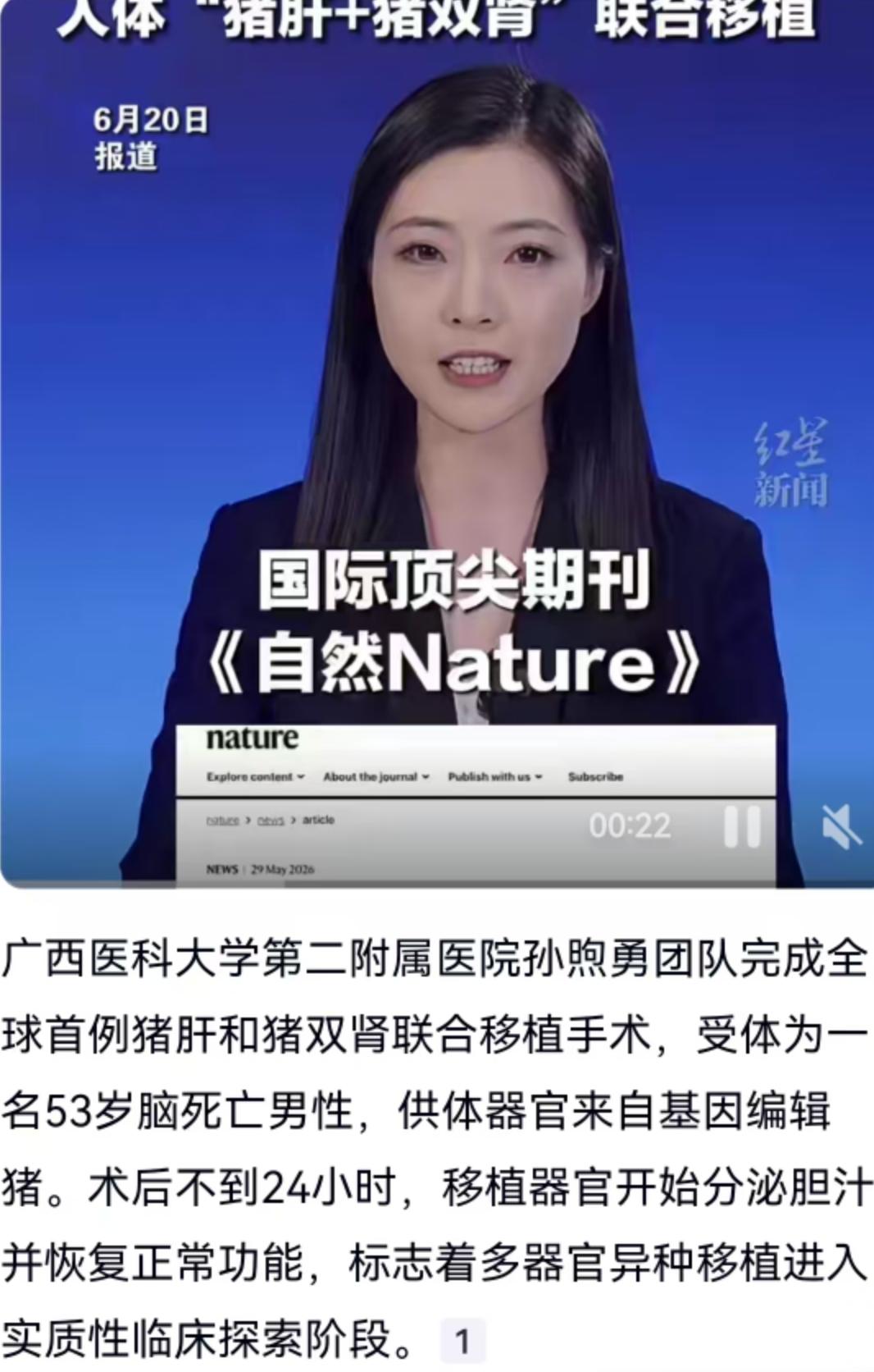 广西医科大学第二附属医院的手术室内，无影灯下，一场改写医学历史的手术刚刚落幕。孙
