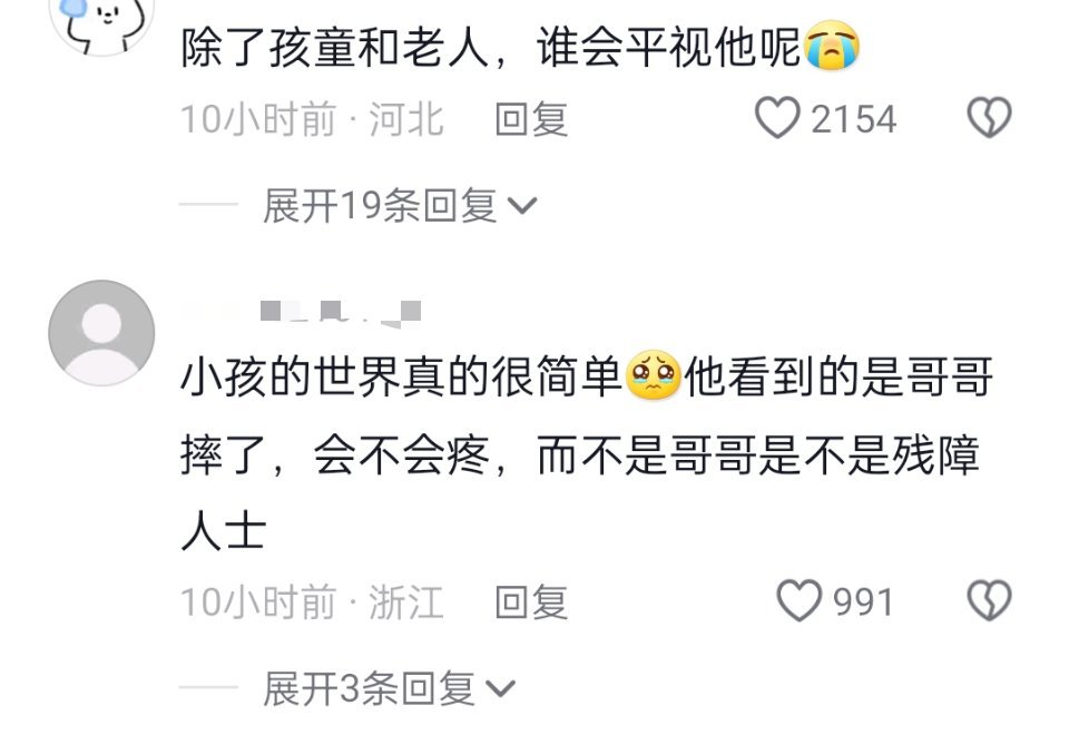 刘春和说：我和很多目光撞上过，有怜悯的、有恐惧的、也有厌恶我的，但是很少有敢直视