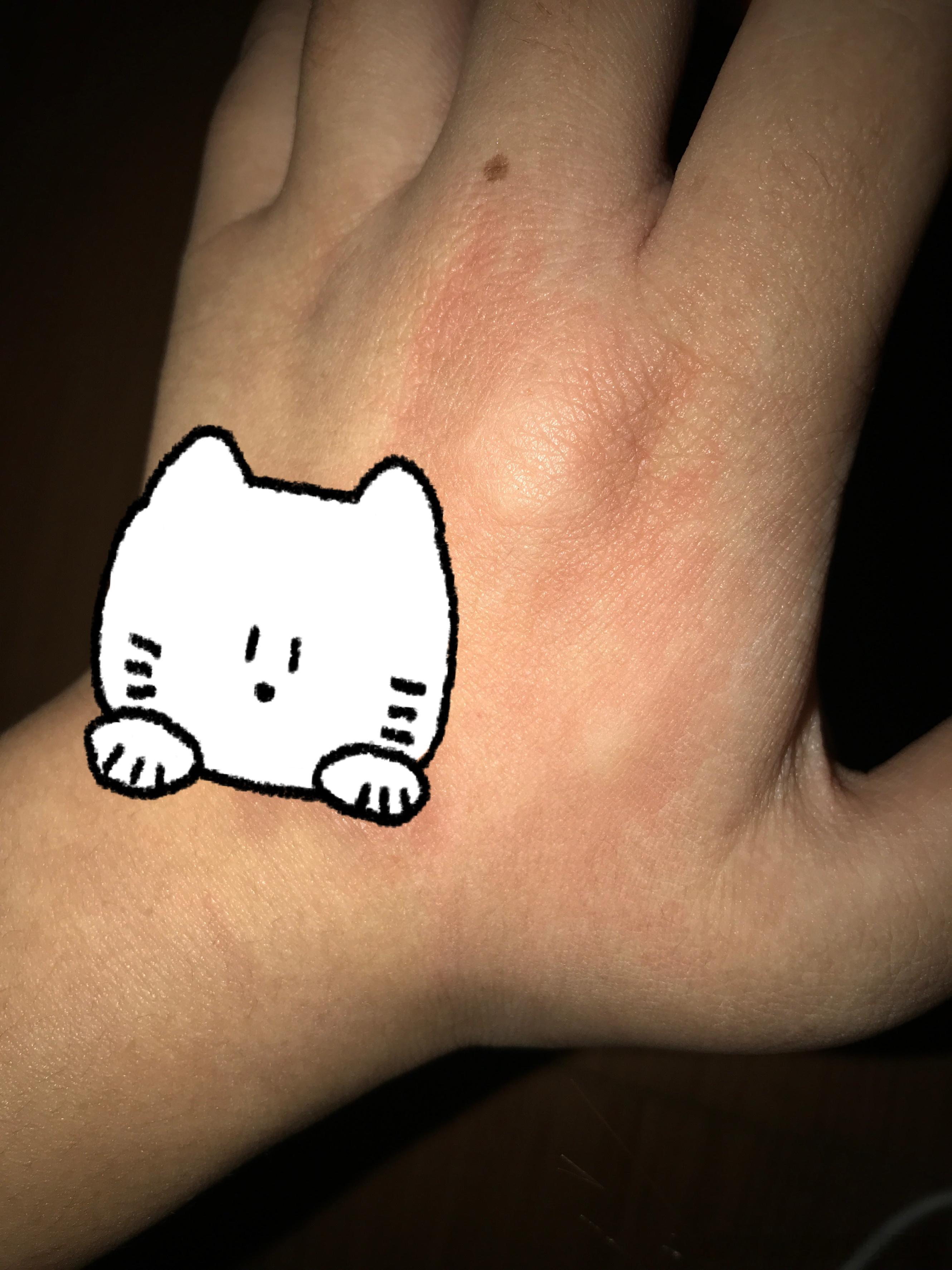 蚊子你咬的是不是有点狠了