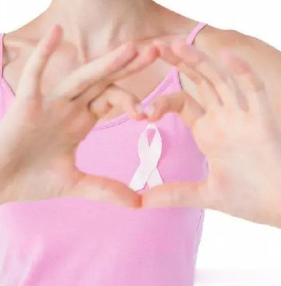 乳腺癌的早期表现是乳腺出现肿块1.乳房肿块：  常为乳腺癌的最常见体征，约80%