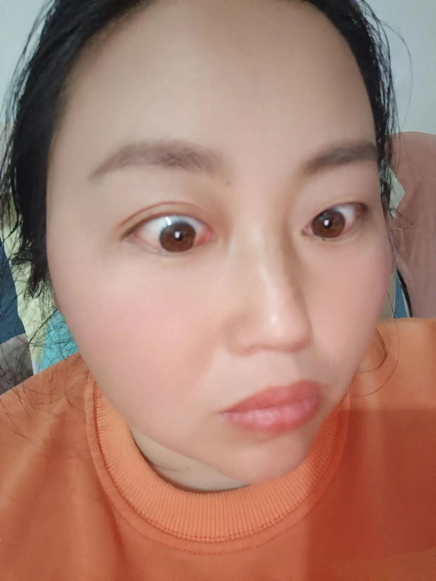 受伤总是我，眼睛已经痛了10天了