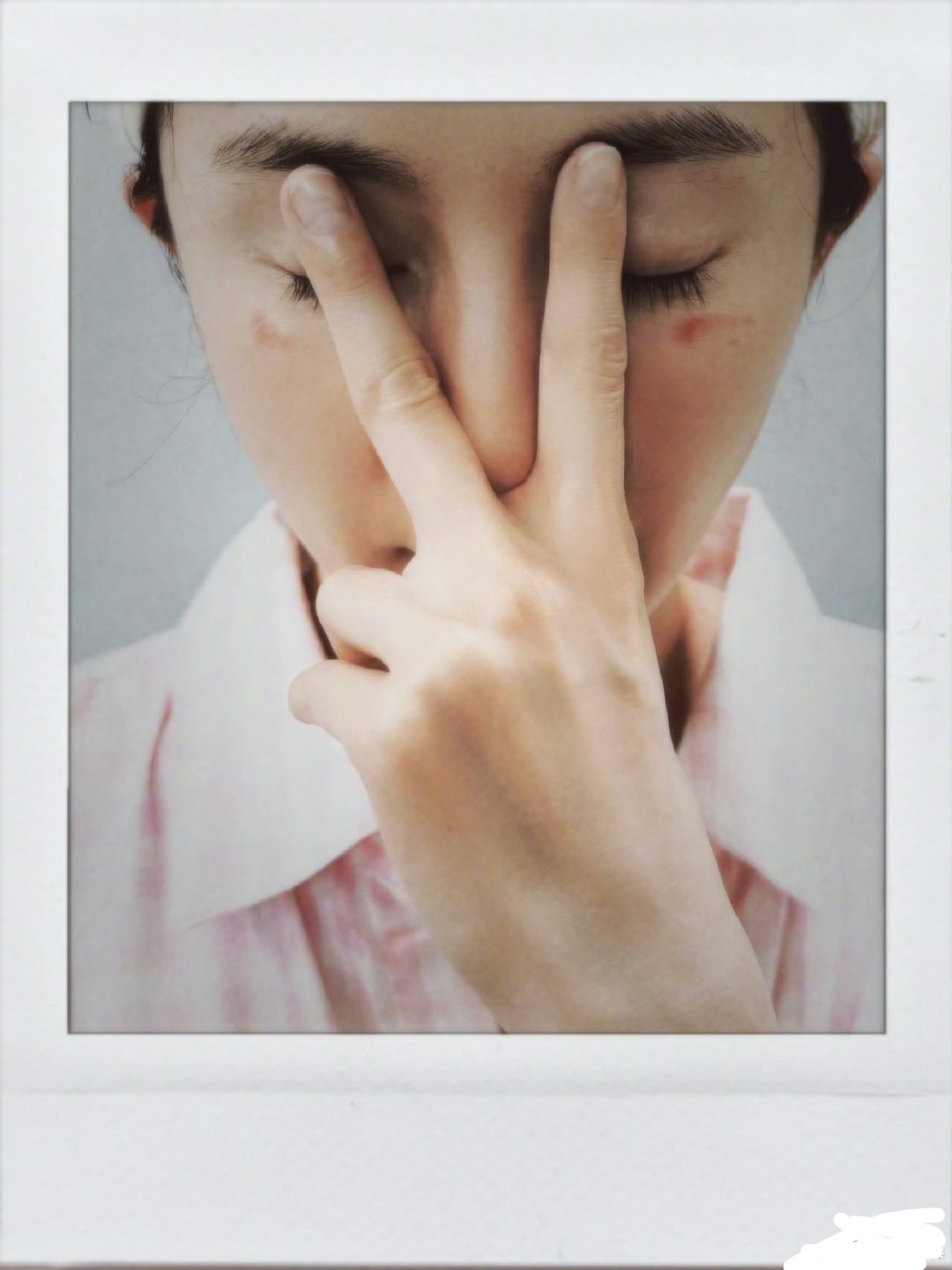 蒸汽眼罩坏！好明显的烫伤红印子啊。杨幂脸被蒸汽眼罩烫伤了杨幂说蒸汽眼罩咬我