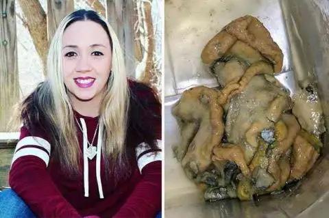 事件概况
 
河南郑州田女士4月1日在百果园花7.9元买了个新鲜椰子，喝时觉得椰