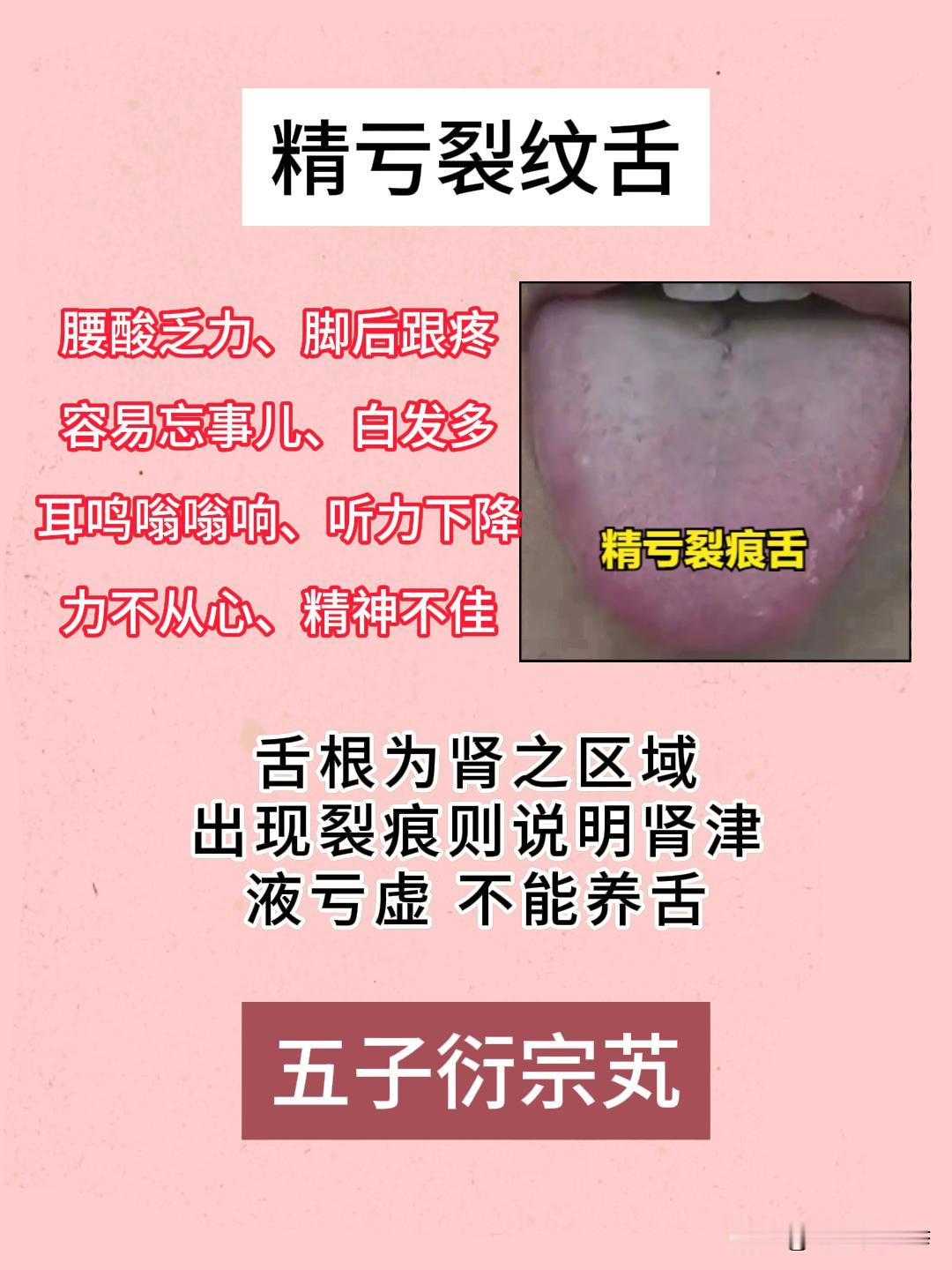 裂纹舌怎么调？一次给你讲清楚