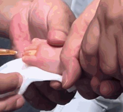 悲剧还是发生了！ 
 
浙江一位宝妈，怎么也想不到，自己才三个月大的宝宝，就安安