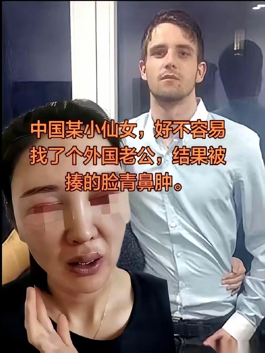 被打了。
就是那个前阵子在朋友圈疯狂刷屏，逢人便炫耀自己“嫁给老外、嫁给了真正的