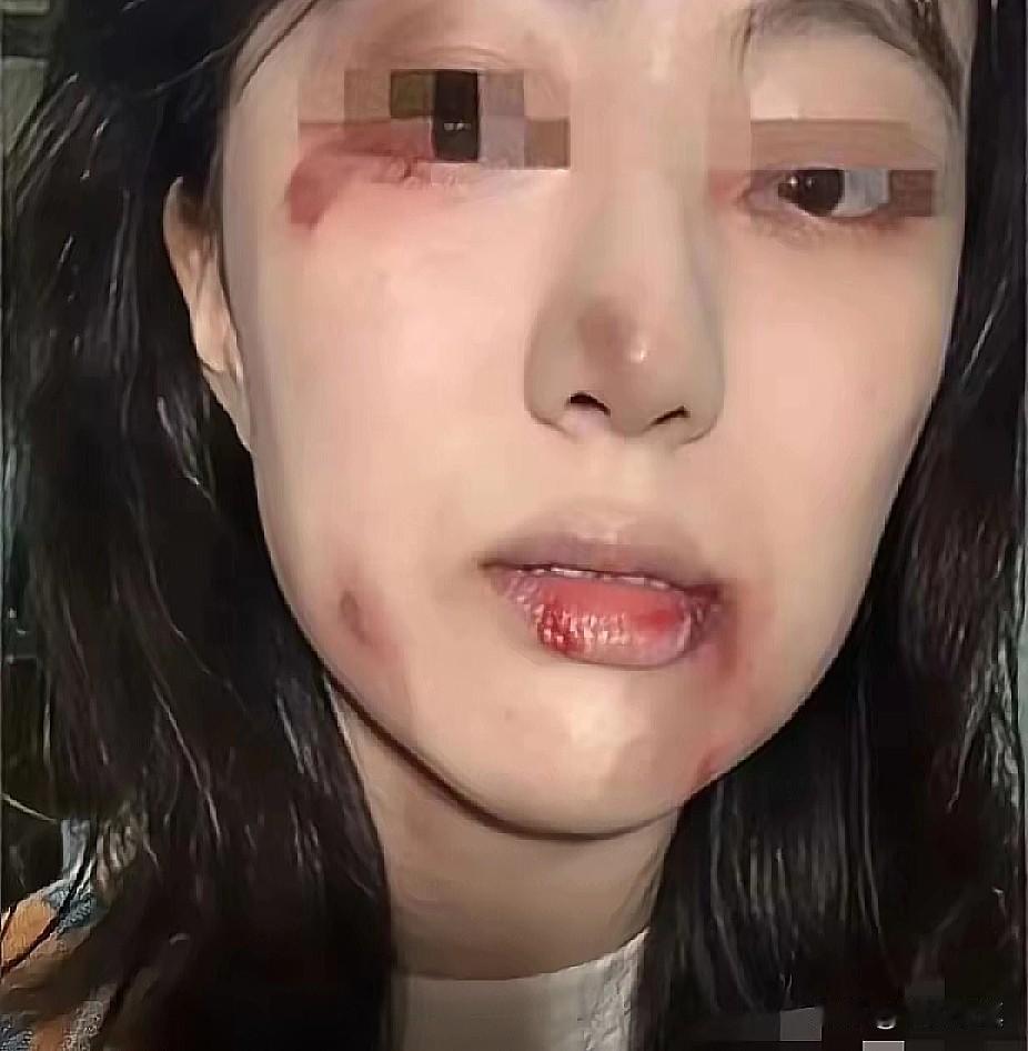 太解气了！大姐买药遭卖鱼的拳殴，买鱼大姐遭网暴，

一条鱼引起争议，这几天江西买