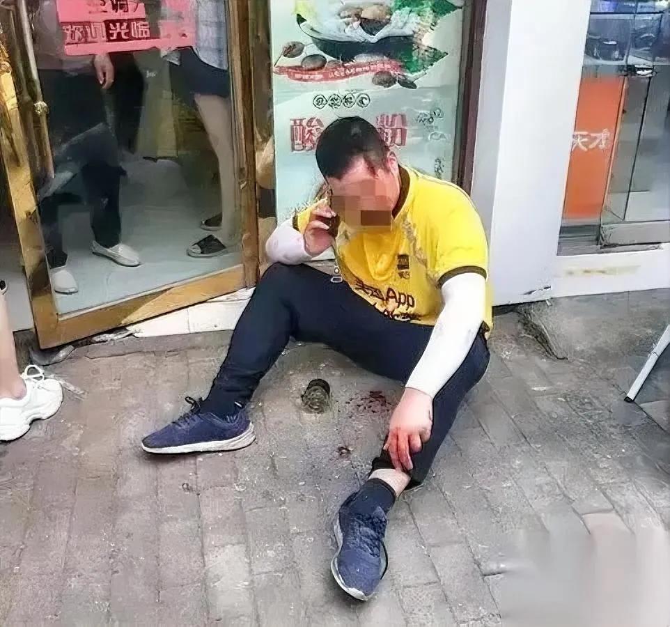 外卖没送上楼

顾客直接动手了——

把广东清远这小哥揍到轻伤一级？

事儿特戳