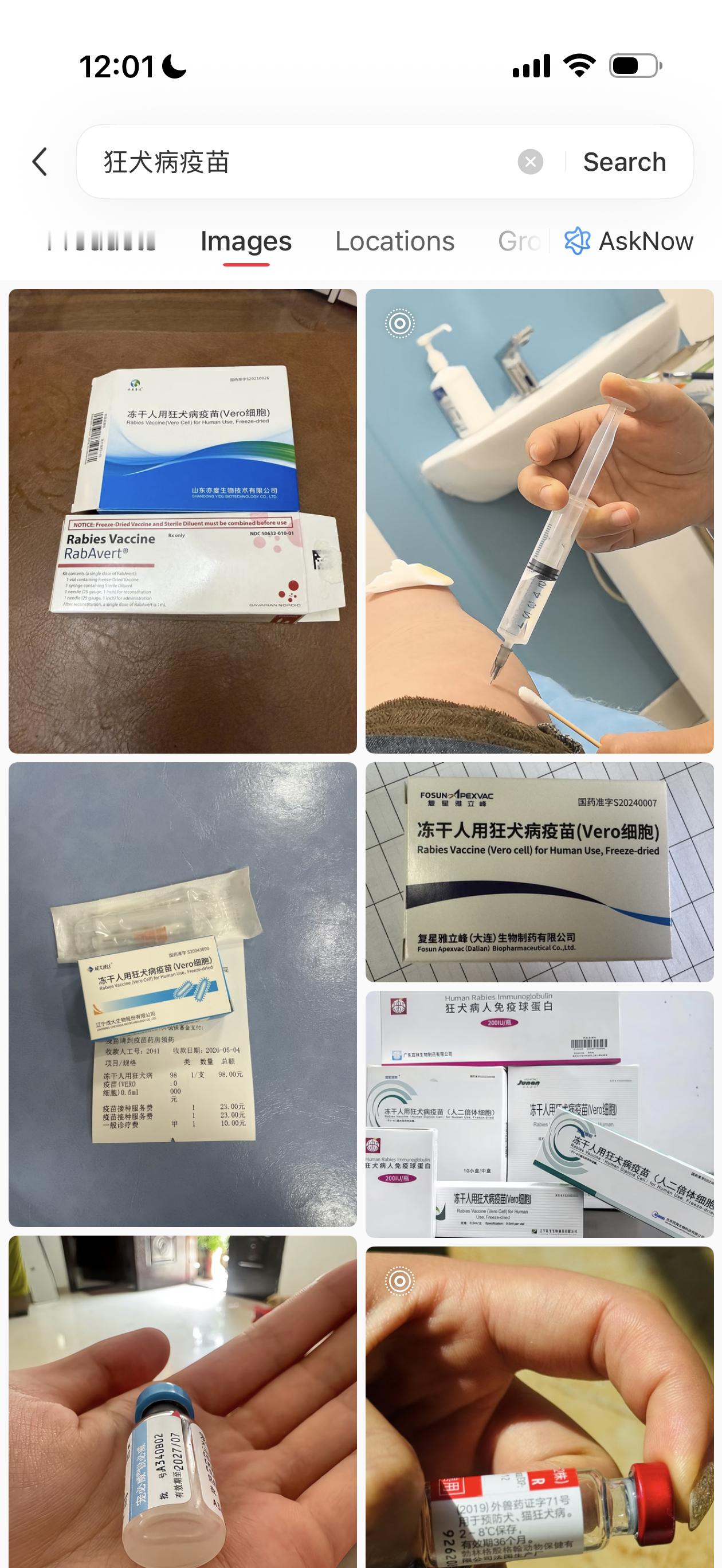 狗咬人，人不能咬狗。人被咬后，第一步立刻冲洗伤口；第二步立即就医打疫苗；第三步同