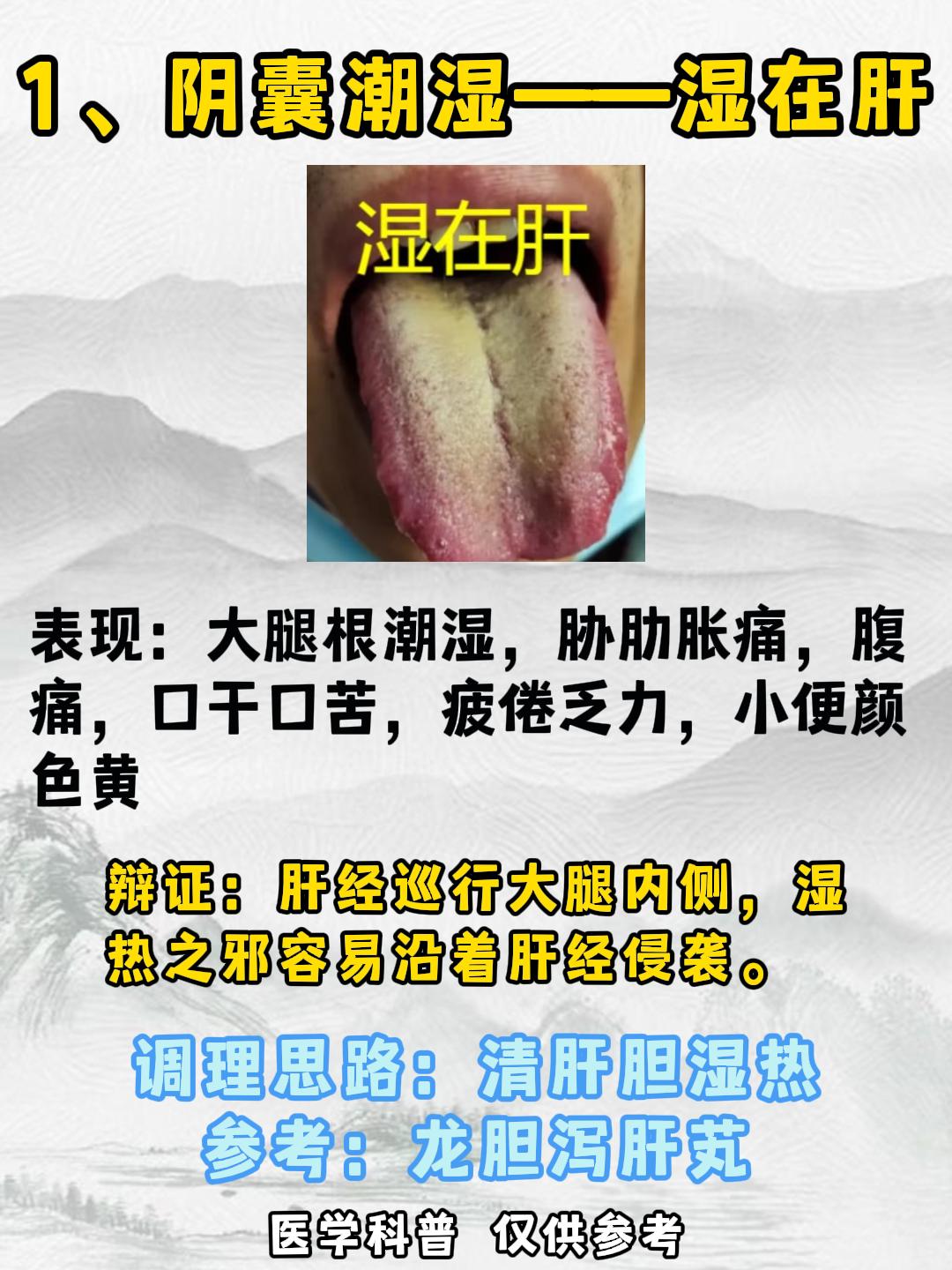 阴囊潮湿——湿在肝，时间短——湿在脾，疲软无力——湿在肾！
#涨知识##健康##