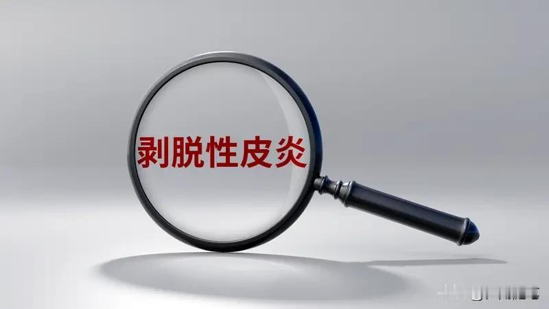 特异性皮炎当然得治疗！这病可折磨人了。我有个朋友就深受其害，皮肤瘙痒难耐，一挠就