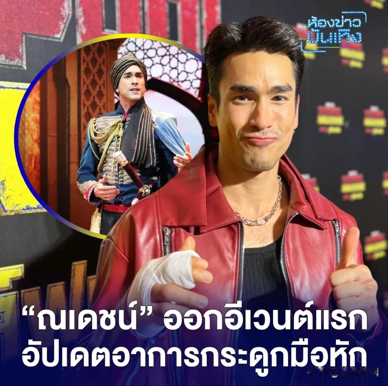 #泰国娱乐# 【Nadech：手指受伤康复中】稍前一段时间，Nadech由于健身