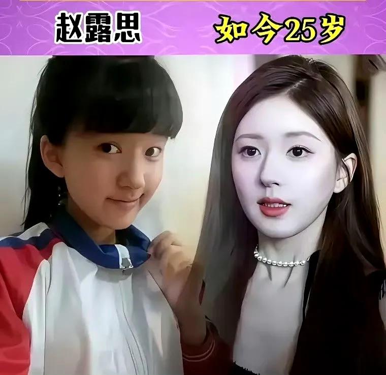 女星前后变化，鞠敬伟、杨紫像换了一个人。

分享几张娱乐圈当红女星前后对比照片，