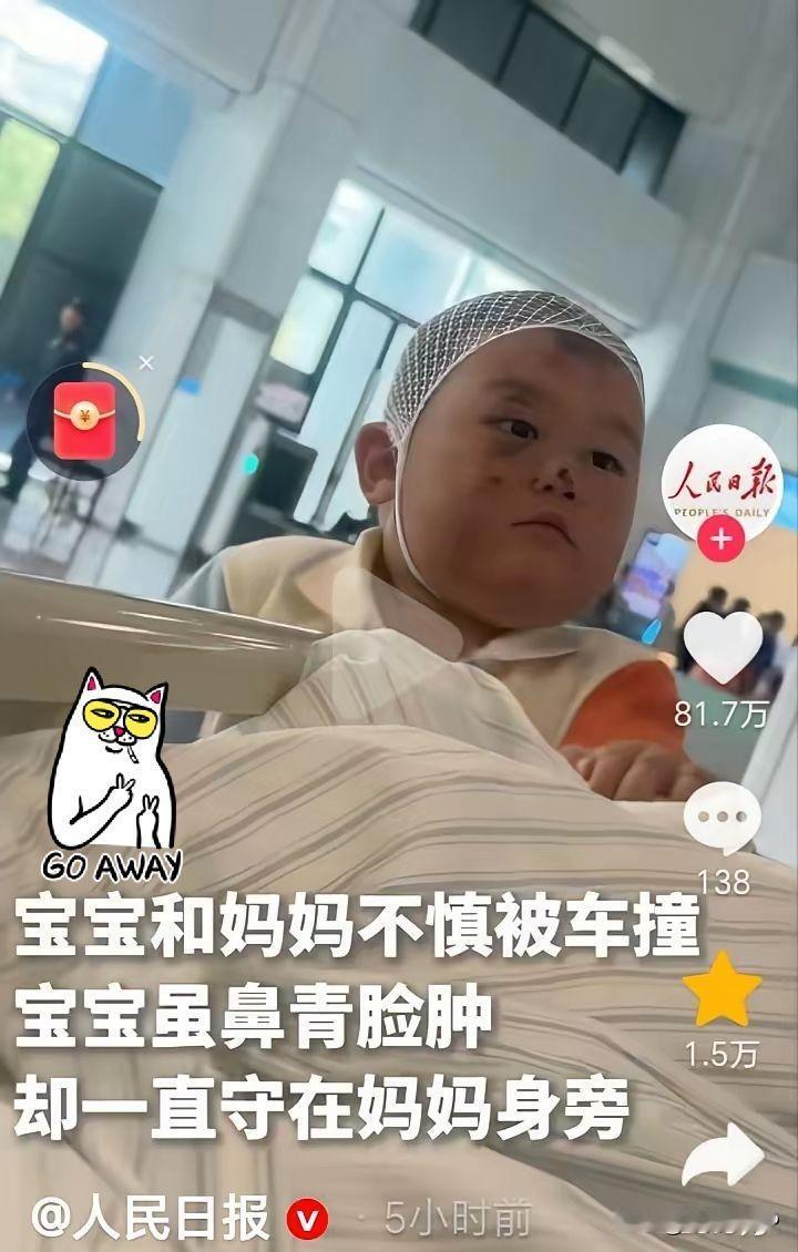 鼻青脸肿的宝宝上人民日报了，明明也受伤了，也很痛，却不哭不闹的跟随着妈妈，眼神坚