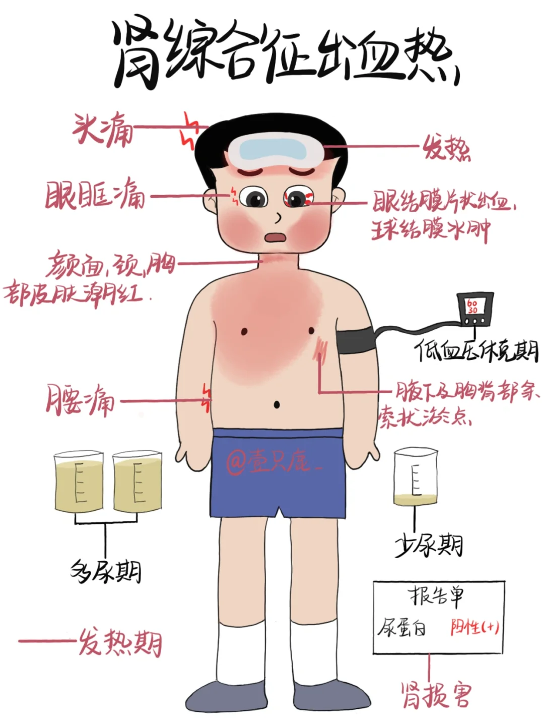 医学生笔记📒｜肾综合征出血热🧐