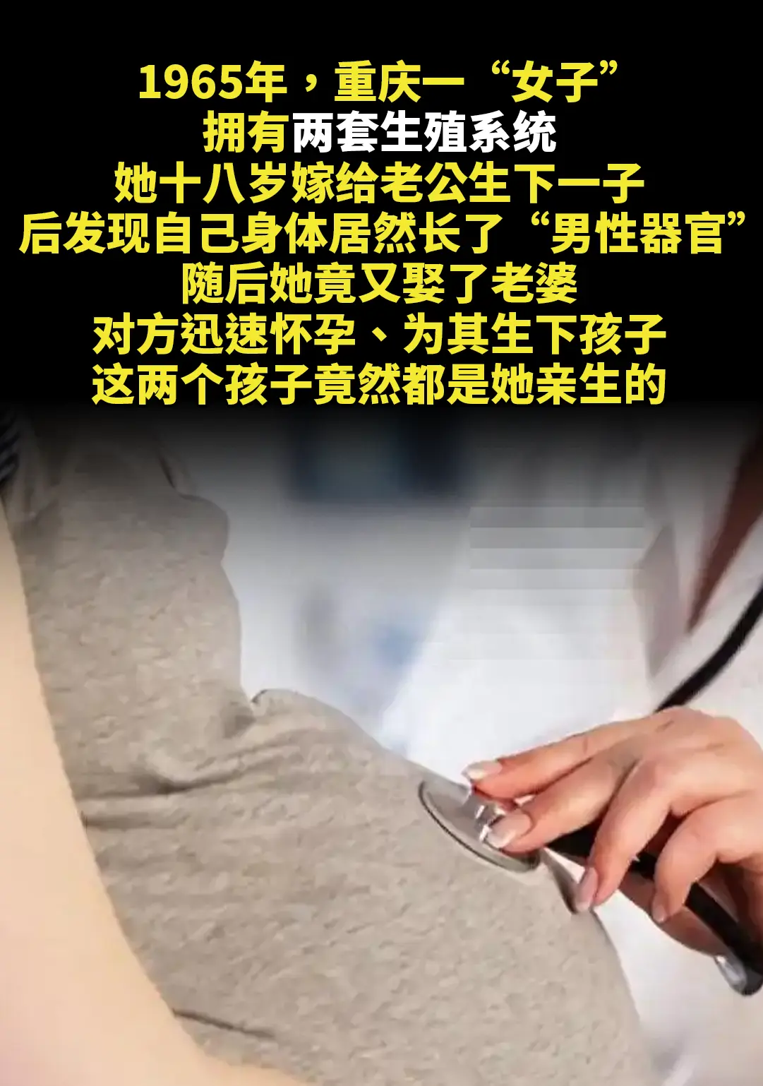 重庆一“女子”拥有两套生殖系统。她十八岁嫁给老公生下一子，后发现自己身...