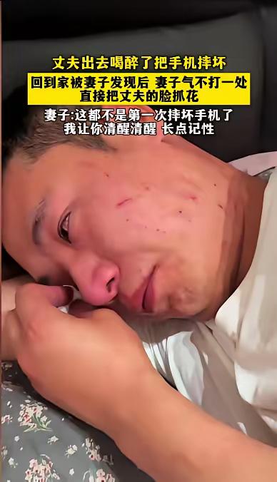 丈夫出去喝醉了把手机摔坏，回到家被妻子发现后，妻子气不打一处，直接把丈夫的脸抓花