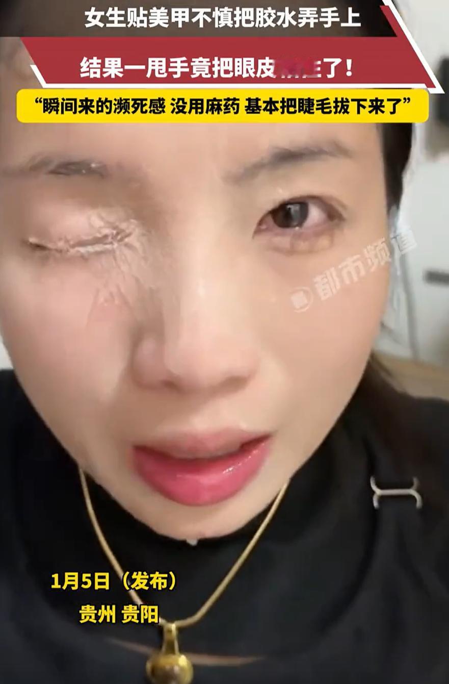 担心的事情还是发生了！贵州贵阳，女子在家中贴美甲片，谁知手上粘了502胶水，随手