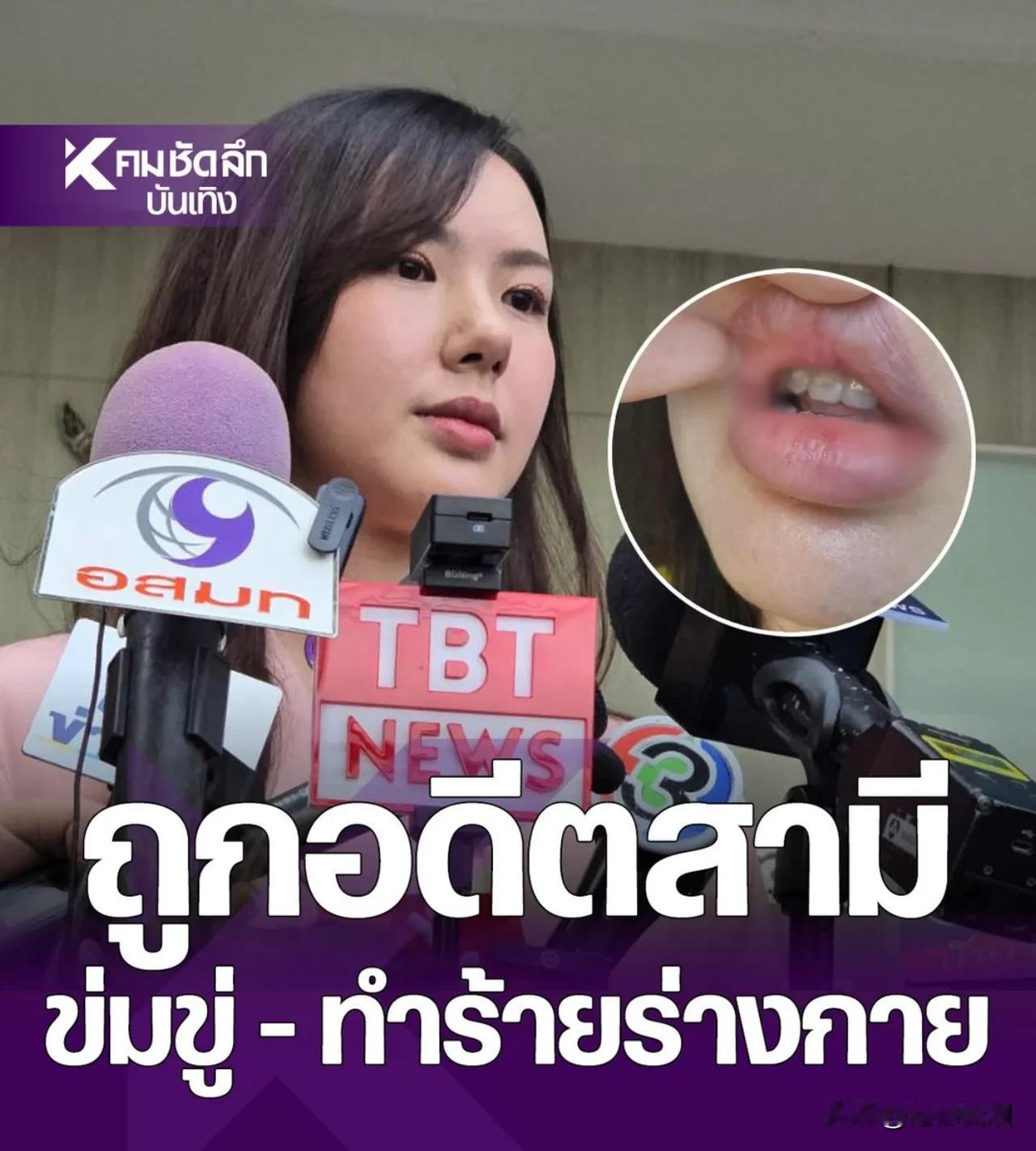 #泰国娱乐# 【Cherreen起诉前夫家暴】Cherreen，也就是尼坤Nic