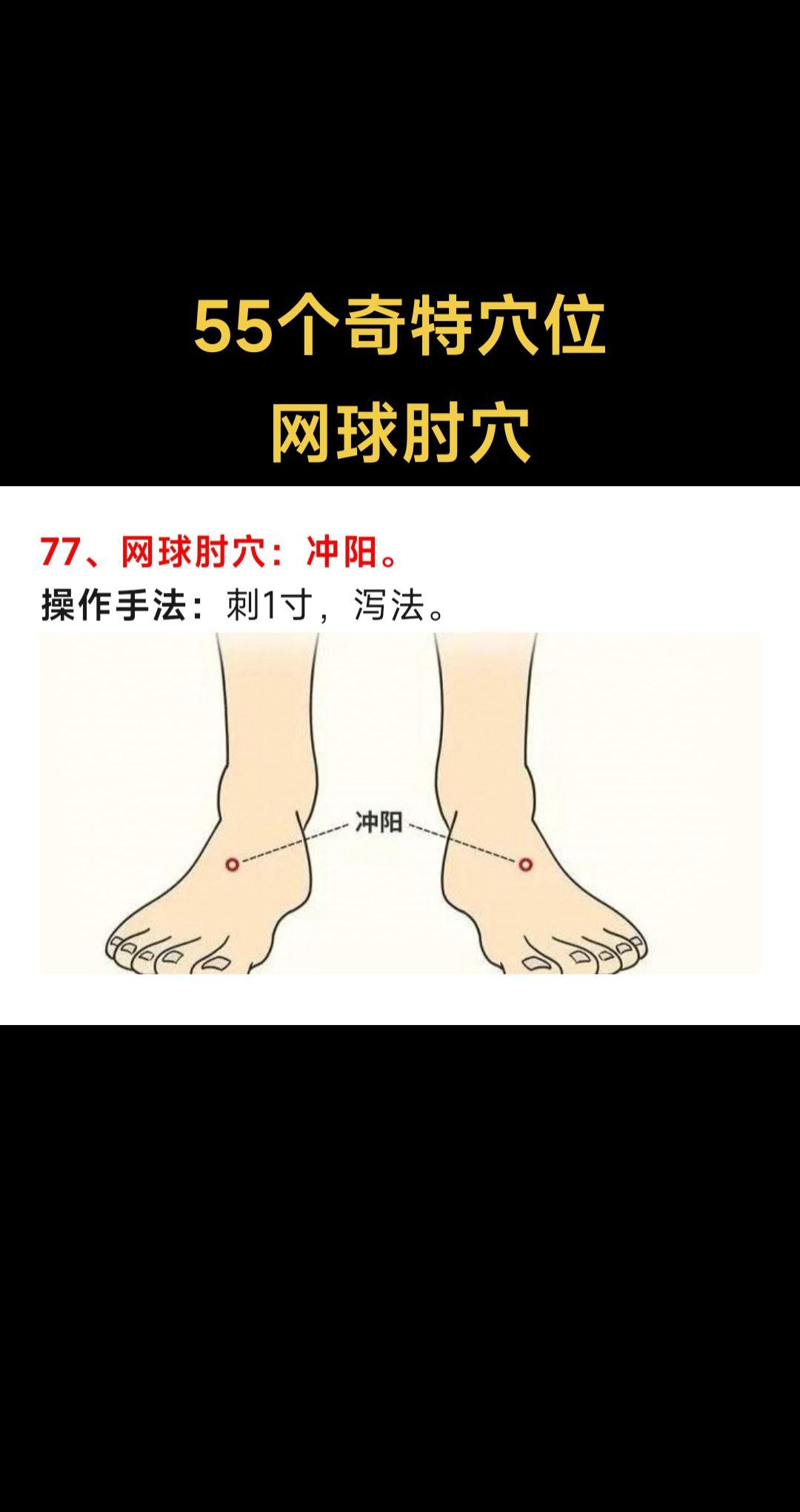 网球肘你听过吗？