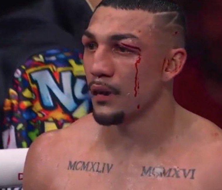 拳坛速递 这比赛 我都能给出 119-109的分。煮酒今日拳击