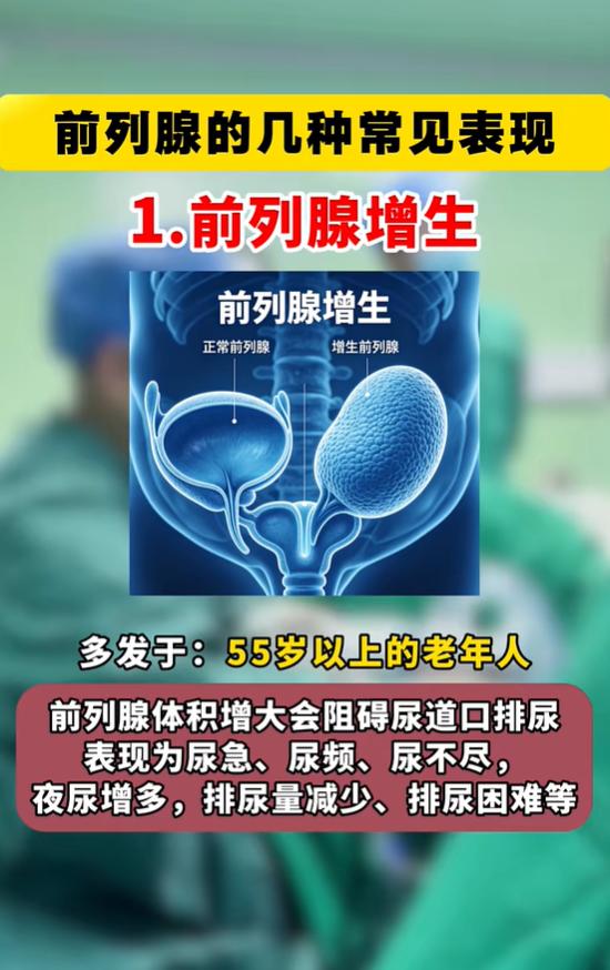 男性下焦腺体三类常见问题解析：高发人群与典型表现对照