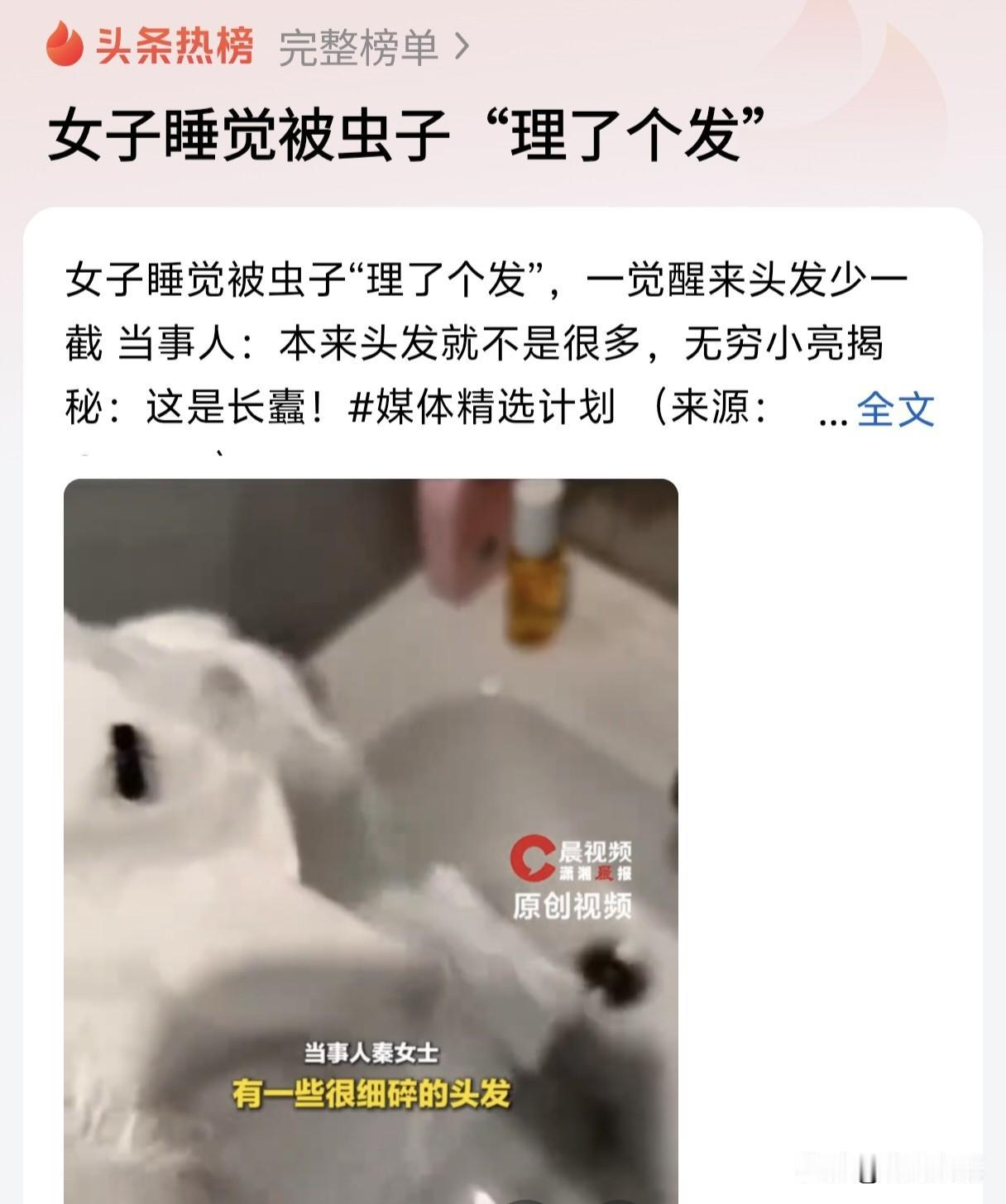 天啦，这是个什么虫子🐛🐛🐛居然是个“理发师”。

作为上了年纪的人儿，头发
