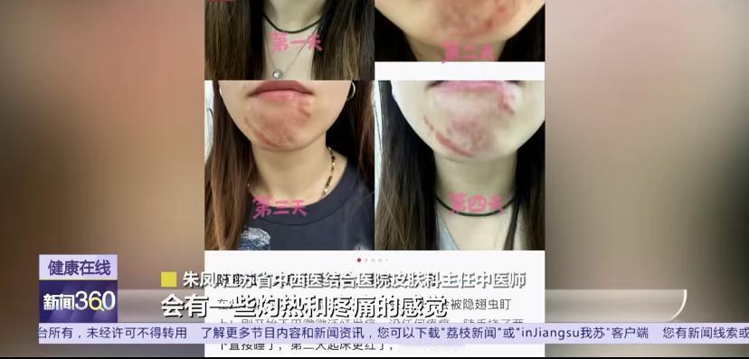 最近不少人家里进了"黑红相间"的小虫子，北京、河南都有网友中招。有人顺手一拍，结