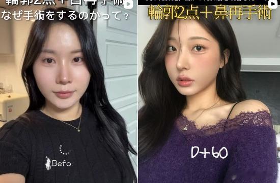 韩国的医院现在真的是都喜欢做樱花妹 