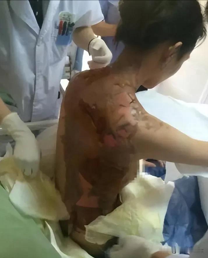 “这就是嘴欠的下场”！2015年浙江女子吃火锅催汤，辱骂服务员母亲，惨遭整盆热水