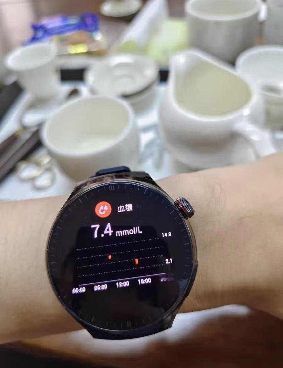 1月10日报道，老人花84元买的测血糖“手表”竟能给家中吸尘器、相机、矿泉水瓶等