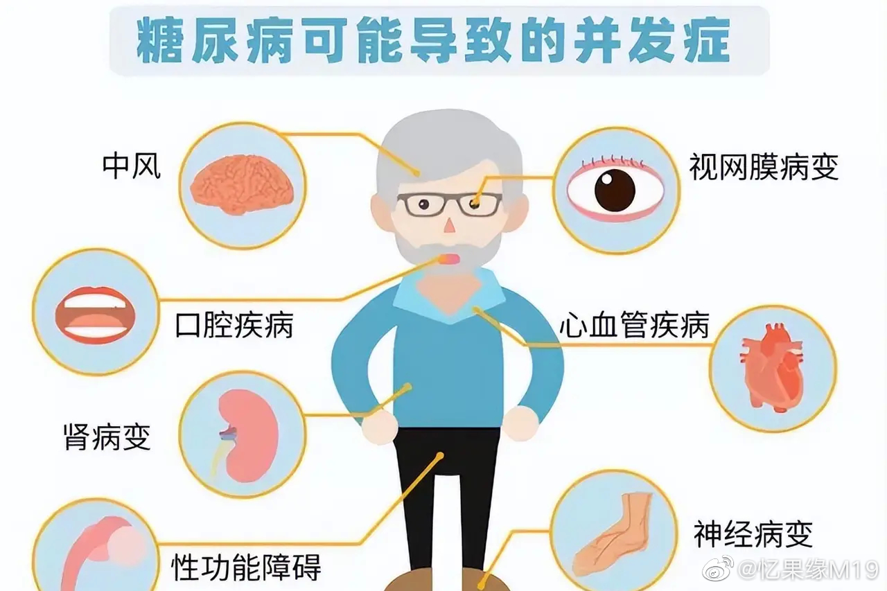 糖尿病的全身表现都有哪些呢？看看大家有没有中招1.糖尿病神 经病 四肢麻木、神经