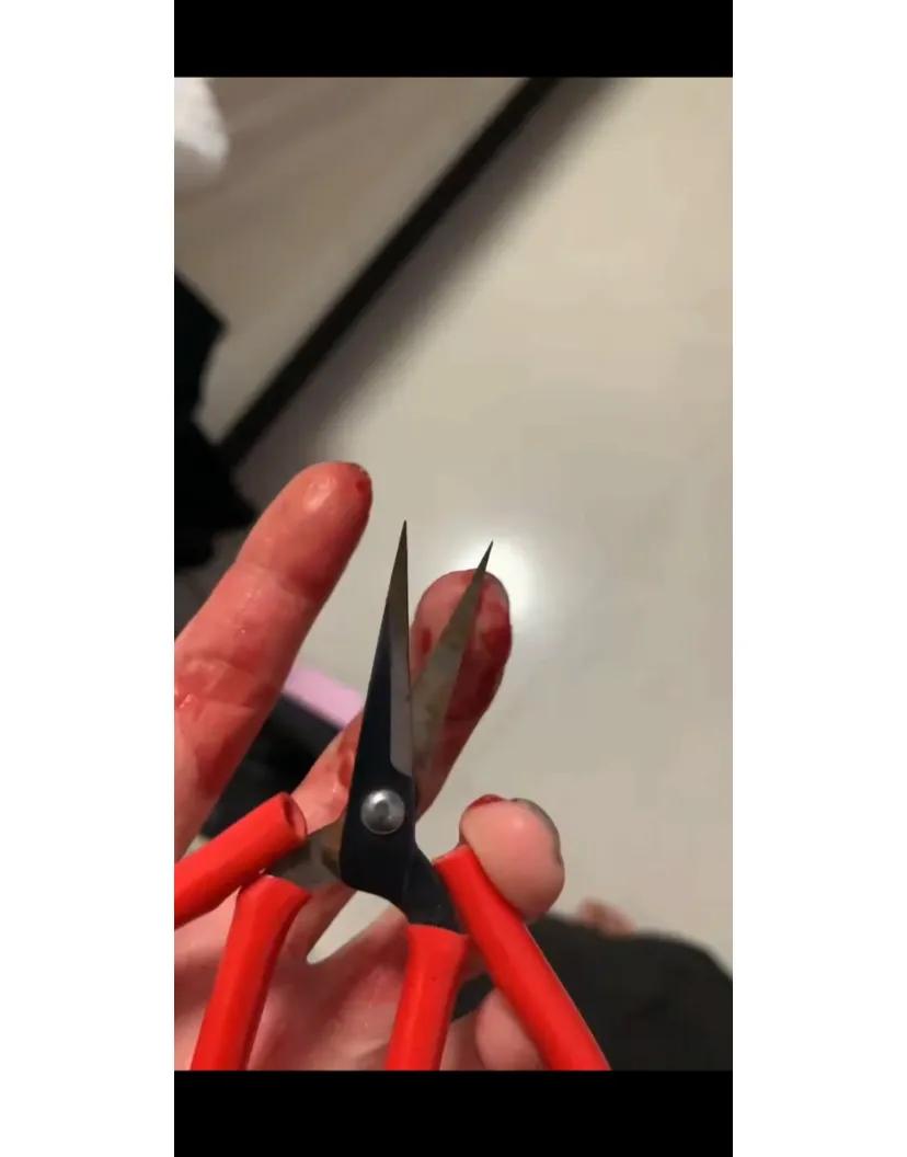 需要打破伤风吗
被有点锈的剪子扎到了有6毫米那么深吧出了很多血#破伤风